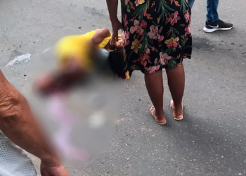 Mulher tem perna dilacerada após ser atropelada por ônibus, na Baixada Fluminense