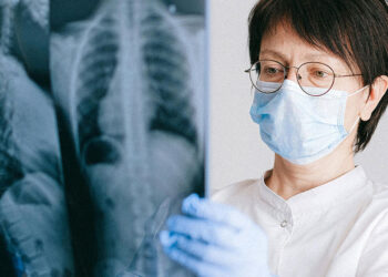 Caxias intensifica medidas de prevenção e controle da tuberculose.