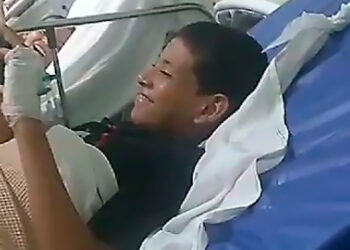 Menino de 12 anos é mordido por jacaré na Cidade de Deus.