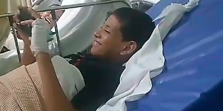 Menino de 12 anos é mordido por jacaré na Cidade de Deus.